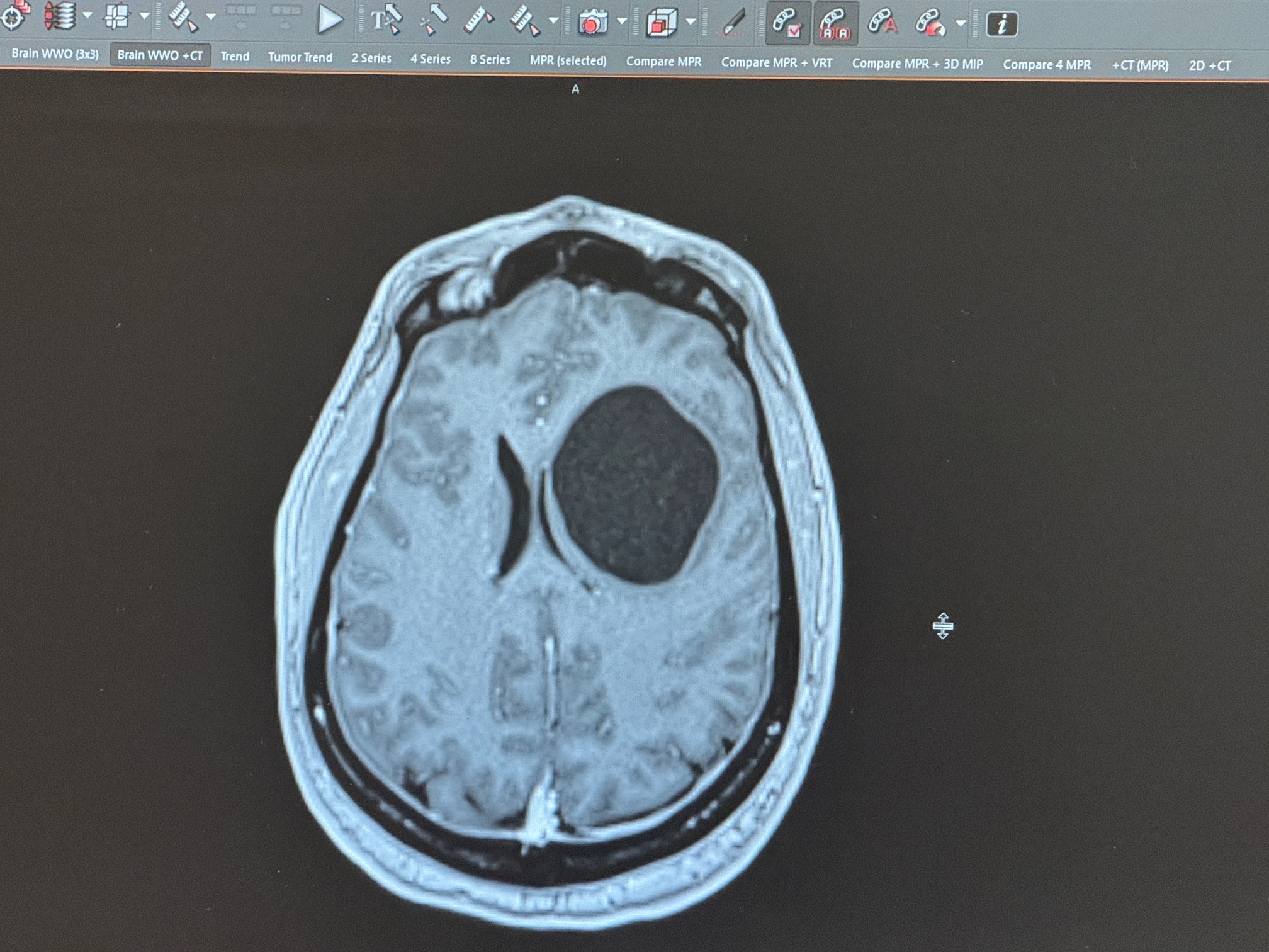 A Personal Update